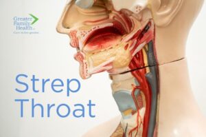 Strep Throat